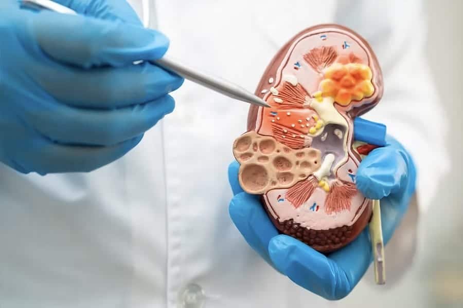Cancers Urologiques